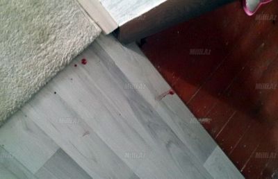 Məktəbli qıza hücum edilib - FOTO Məktəbli qıza hücum edilib - FOTO