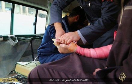 İŞİD-in əl kəsmə qaydası - ŞOK FOTOLAR