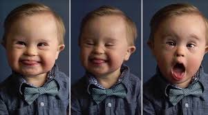 Sosial media bu körpəndən danışır - FOTO Sosial media bu körpəndən danışır - FOTO