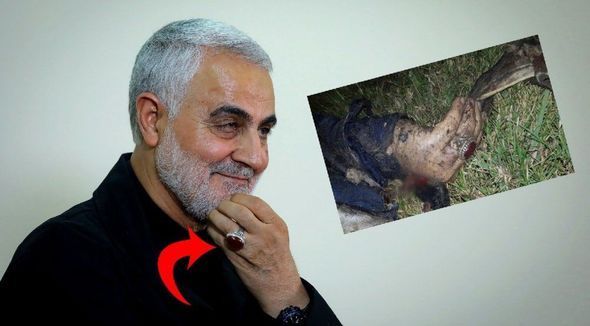 Süleymaninin parçalanmış meyiti barmağındakı üzüyə görə tanınıb - FOTO