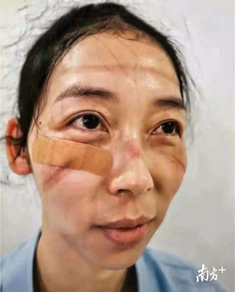 Çində koronavirus həkimləri bu vəziyyətə saldı – FOTO