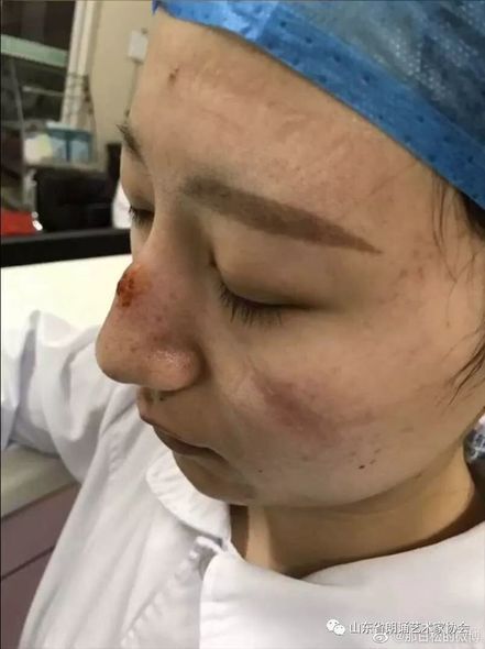 Çində koronavirus həkimləri bu vəziyyətə saldı – FOTO