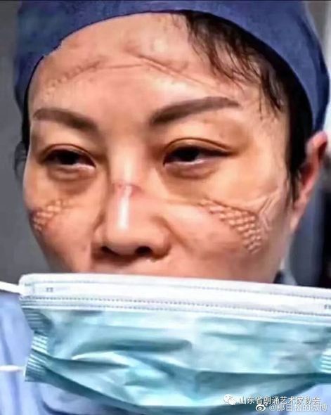 Çində koronavirus həkimləri bu vəziyyətə saldı – FOTO