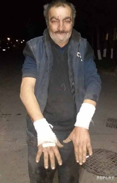 Bakıda canavar 54 yaşlı kişiyə hücum etdi - FOTO
