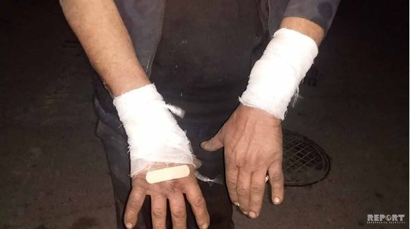 Bakıda canavar 54 yaşlı kişiyə hücum etdi - FOTO